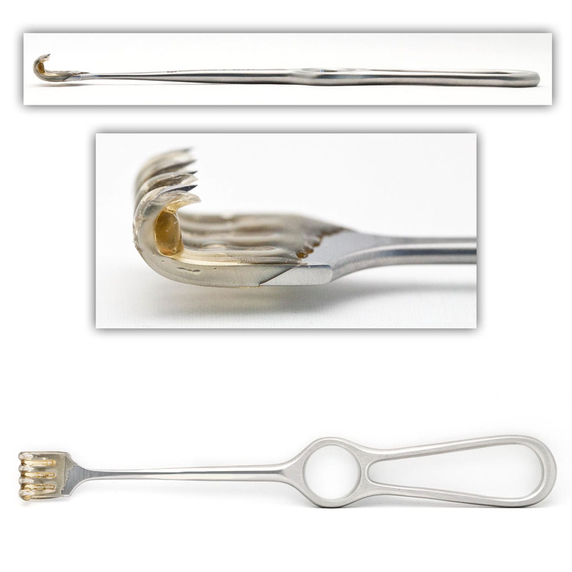Volkman Retractor
